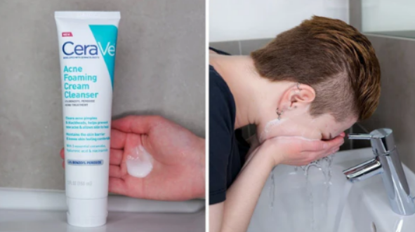 CeraVe Acne Foaming Cream Cleanser – 150 ml