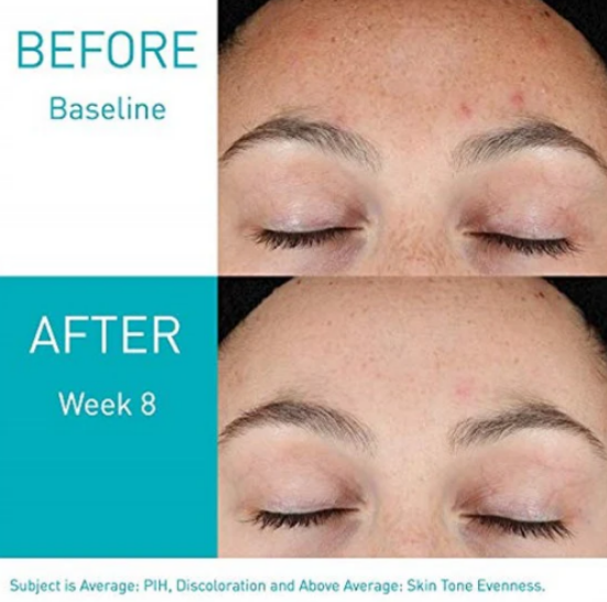 Cerave Resurfacing Retinol Serum Smooth & Revitalize Your Skin